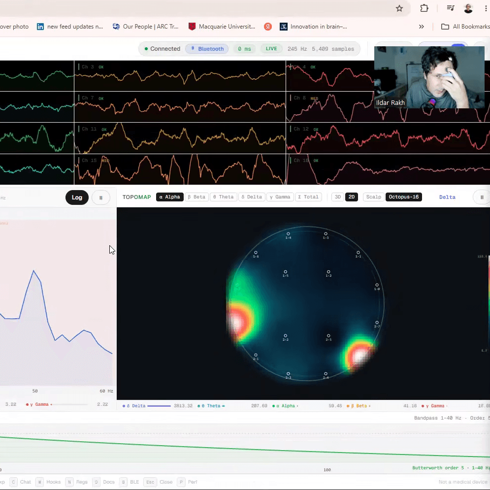 Uninvasive EEG Interface Could Be Used To Play Games